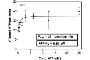 Image no. 2 for Proto-Oncogene Pim-2 (Serine Threonine Kinase) (PIM2) (AA 1-311) (Active) protein (His-GST) (ABIN5569599)