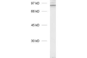 Western Blotting (WB) image for anti-Cortactin (CTTN) (N-Term) antibody (ABIN1742565) (Cortactin Antikörper  (N-Term))