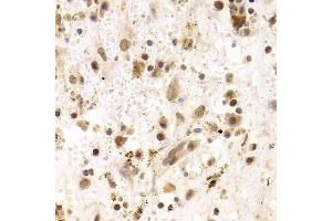 Immunohistochemistry (Paraffin-embedded Sections) (IHC (p)) image for anti-PRP3 Pre-mRNA Processing Factor 3 Homolog (PRPF3) (AA 1-280) antibody (ABIN6146260)