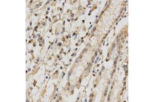 Immunohistochemistry of paraffin-embedded human stomach using RBFOX3 antibody at dilution of 1:200 (x400 lens). (NeuN Antikörper)