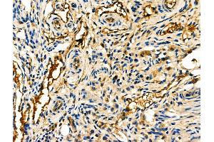 ABIN6261239 and ABIN6276806 at 1/100 staining Mouse ovarian tissue by IHC-P.