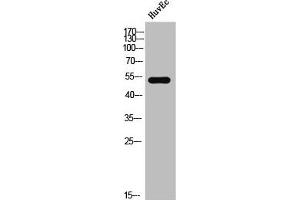 Western Blot analysis of HuvEc cells using Phospho-DAPK3 (T265) Polyclonal Antibody (DAPK3 Antikörper  (pThr265))