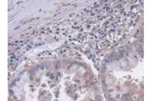 Used in DAB staining on fromalin fixed paraffin-embedded Liver tissue (SLC30A8 Antikörper  (AA 263-369))