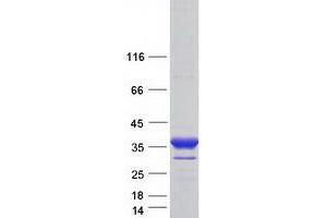 Validation with Western Blot (BCAP31 Protein (Transcript Variant 1) (Myc-DYKDDDDK Tag))