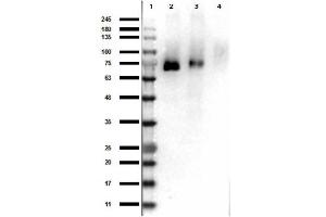 Western Blot Results of Rabbit Anti-RONpY1353 Antibody. (MST1R Antikörper  (Internal Region, pTyr1353))