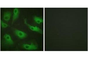 Immunofluorescence analysis of HeLa cells, using CDC37 (Ab-13) Antibody. (CDC37 Antikörper  (AA 1-50))