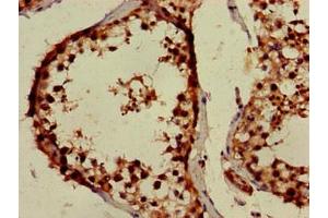 Immunohistochemistry (IHC) image for anti-Protoporphyrinogen Oxidase (PPOX) (AA 1-477) antibody (ABIN7166589)