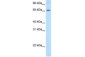 Human Thymus; WB Suggested Anti-ADAT1 Antibody Titration: 0. (ADAT1 Antikörper  (C-Term))