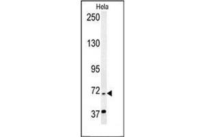 Western Blotting (WB) image for anti-Excision Repair Cross-Complementing Rodent Repair Deficiency, Complementation Group 6-Like 2 (ERCC6L2) (AA 12-43), (N-Term) antibody (ABIN954433)