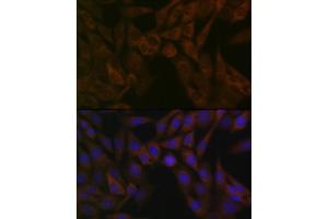 Immunofluorescence analysis of NIH-3T3 cells using  Rabbit mAb (ABIN7265484) at dilution of 1:100 (40x lens). (ARF5 Antikörper)