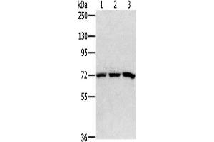 Gel: 6 % SDS-PAGE,Lysate: 40 μg,Lane 1-3: 293T cells, HepG2 cells, K562 cells,Primary antibody: ABIN7192647(SRP68 Antibody) at dilution 1/200 dilution,Secondary antibody: Goat anti rabbit IgG at 1/8000 dilution,Exposure time: 5 seconds (SRP68 Antikörper)