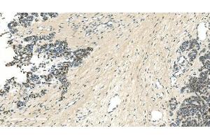 IHC analysis of LSM5 using anti-LSM5 antibody (ABIN7602503).