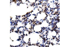 IHC analysis of KLF15 using anti-KLF15 antibody (ABIN7599269). (KLF15 Antikörper  (AA 1-323))