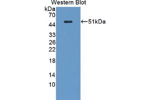 Figure. (Casein Kinase 1 delta Antikörper  (AA 1-409))