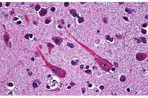Human Brain, Cortex: Formalin-Fixed, Paraffin-Embedded (FFPE) (PCSK1 Antikörper  (AA 652-754))