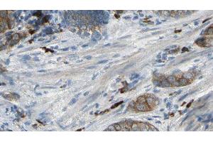 ABIN6277046 at 1/100 staining Human prostate tissue by IHC-P. (CAPZA2 Antikörper  (Internal Region))