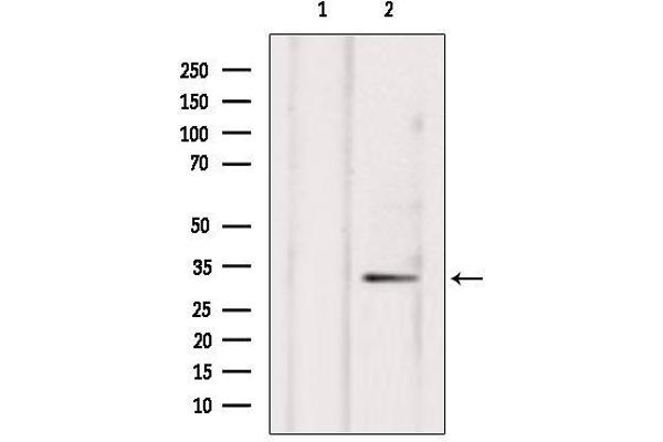 Neurexophilin 4 Antikörper  (Internal Region)