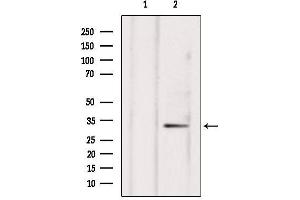 Western blot analysis of extracts from hepg2, using NXPH4 Antibody. (Neurexophilin 4 Antikörper  (Internal Region))