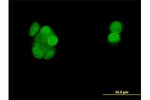 Immunofluorescence of monoclonal antibody to PGR on MCF-7 cell.