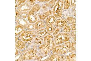 Immunohistochemistry of paraffin-embedded rat kidney using TRIM21/SS-A Rabbit pAb (ABIN6131376, ABIN6149506, ABIN6149507 and ABIN6217587) at dilution of 1:50 (40x lens). (TRIM21 Antikörper  (AA 80-330))
