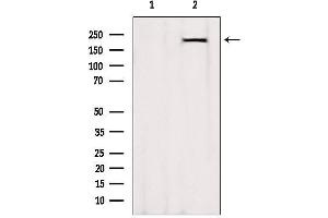 Western blot analysis of extracts from Rat heart, using MYH7-specific Antibody. (MYH7 Antikörper  (C-Term))