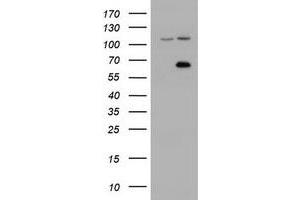Image no. 3 for anti-Zinc Finger, Imprinted 2 (ZIM2) (AA 1-150), (AA 428-527) antibody (ABIN1490591) (ZIM2 Antikörper  (AA 1-150, AA 428-527))