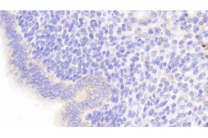 Immunohistochemistry (IHC) image for anti-serpin Peptidase Inhibitor, Clade F (Alpha-2 Antiplasmin, Pigment Epithelium Derived Factor), Member 1 (SERPINF1) (AA 19-417) antibody (ABIN7434440)