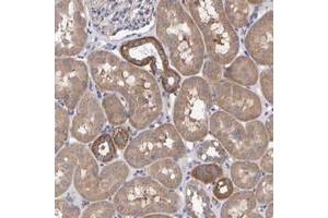 Immunohistochemical staining of human kidney with EFR3A polyclonal antibody  shows cytoplasmic positivity in tubular cells at 1:50-1:200 dilution. (EFR3A Antikörper)