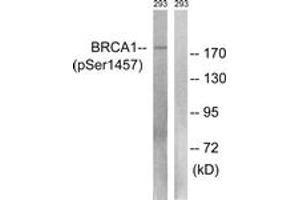 Western blot analysis of extracts from 293 cells treated with epo 20U/ml 15', using BRCA1 (Phospho-Ser1457) Antibody. (BRCA1 Antikörper  (pSer1457))