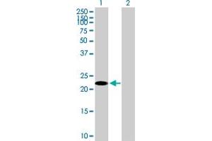Western Blot analysis of TSC22D3 expression in transfected 293T cell line by TSC22D3 MaxPab polyclonal antibody. (TSC22D3 Antikörper  (AA 1-200))