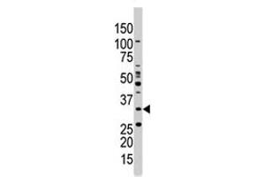 The PRKAB1 polyclonal antibody  is used in Western blot to detect PRKAB1 in Jurkat cell lysate . (PRKAB1 Antikörper  (N-Term))