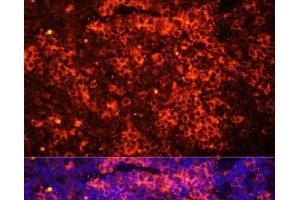 Immunofluorescence analysis of Mouse spleen using TLR8 Polyclonal Antibody at dilution of 1:100 (40x lens). (TLR8 Antikörper)