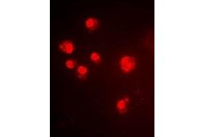 Immunofluorescent analysis of ALG-2 staining in Hela cells. (ALG2 Antikörper)