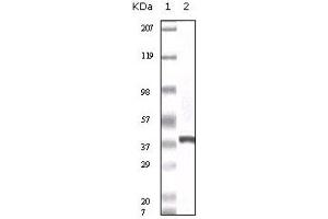 Western blot analysis using calcyclin mouse mAb against truncated calcyclin recombinant protein. (S100A6 Antikörper)