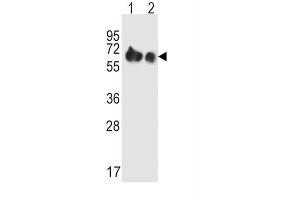 Western Blotting (WB) image for anti-Solute Carrier Family 3 (Activators of Dibasic and Neutral Amino Acid Transport), Member 2 (SLC3A2) antibody (ABIN2995541)