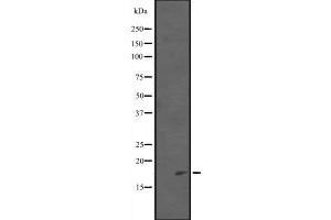 Western blot analysis of PDCD5 expression in EL4 cell lysate ;,The lane on the left is treated with the antigen-specific peptide. (PDCD5 Antikörper  (C-Term))