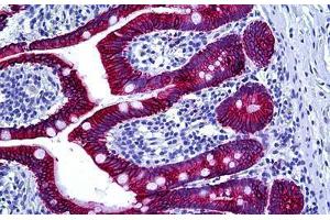 Human Intestine: Formalin-Fixed, Paraffin-Embedded (FFPE) (Keratin Basic Antikörper)