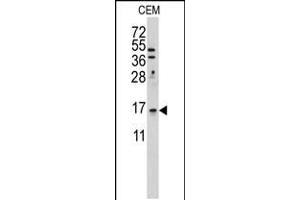 Western blot analysis of anti-LSM1 Antibody in Hela cell line lysates (35ug/lane) (LSM1 Antikörper  (C-Term))