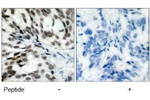 Image no. 1 for anti-Retinoblastoma 1 (RB1) (Ser780) antibody (ABIN197285) (Retinoblastoma 1 Antikörper  (Ser780))