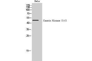 Western Blotting (WB) image for anti-Casein Kinase 1, gamma 2 (CSNK1G2) (N-Term) antibody (ABIN3183661) (Casein Kinase 1 gamma 2 Antikörper  (N-Term))