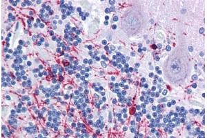 anti-2',3'-Cyclic Nucleotide 3' phosphodiesterase (CNP) (AA 122-352) antibody