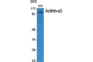 Western Blot (WB) analysis of specific cells using Actinin-alpha3 Polyclonal Antibody. (ACTN3 Antikörper  (N-Term))