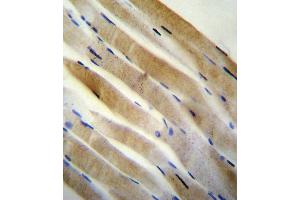 PRK (Thr172) antibody (Center) (ABIN654800 and ABIN2844475) immunohistochemistry analysis in formalin fixed and paraffin embedded human skeletal muscle followed by peroxidase conjugation of the secondary antibody and DAB staining. (PRKAA2 Antikörper  (Thr172))