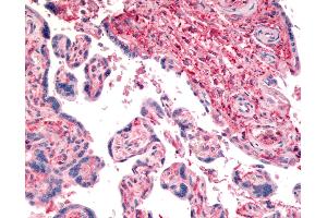 Anti-CD26 antibody IHC of human placenta. (DPP4 Antikörper  (Internal Region))