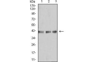 Western Blotting (WB) image for anti-beta-1,3-Glucuronyltransferase 1 (Glucuronosyltransferase P) (B3GAT1) (AA 193-334) antibody (ABIN5917282)