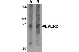 Image no. 1 for anti-Transmembrane Channel-Like 8 (TMC8) (N-Term) antibody (ABIN1494395) (TMC8 Antikörper  (N-Term))