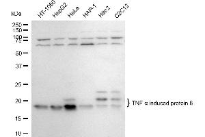 Western blotting analysis using TNF alpha induced protein 8 antibody (ABIN7800679). (Rekombinanter TNFAIP8 Antikörper)