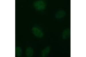 Image no. 2 for anti-Tubulin, beta 2B (TUBB2B) antibody (ABIN1501571) (TUBB2B Antikörper)