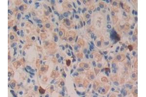 Immunohistochemistry (IHC) image for anti-Transforming Growth Factor, alpha (TGFA) (AA 24-98) antibody (ABIN7429190)