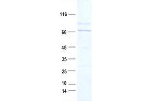 Western Blotting (WB) image for VEGF Receptor 2 (VEGFR2) protein (DYKDDDDK Tag) (ABIN2713633)